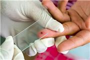 شمار مبتلایان به مالاریا در جنوب کرمان امسال به 17 نفر رسید